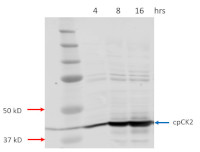 cpCK2 | Casein kinase II subunit alpha (chloroplastic)  in the group Antibodies Plant/Algal  / Photosynthesis  / Kinases at Agrisera AB (Antibodies for research) (AS16 3211)
